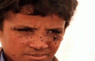 الطفل اليمني .. عقوبة الموت قصفاً! (تحقيق مصور)