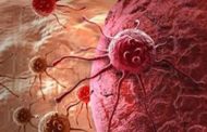 دراسة فرنسية: تدفق الدم يساعد السرطان على الانتشار بالجسم