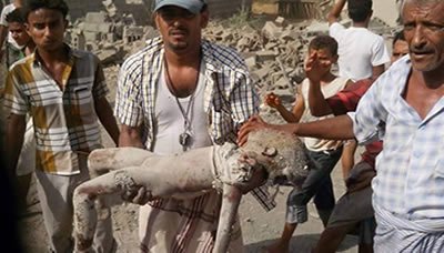 حقوق الإنسان تدعو الأمم المتحدة ووسائل الإعلام لزيارة اليمن للإطلاع على جرائم العدوان