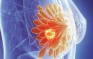 دراسة:الساعة البيولوجية تحد من الإصابة بسرطان الثدي