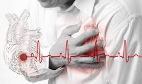 دراسة تربط بين نوع من المسكنات وأمراض القلب
