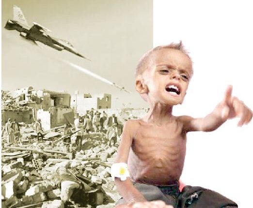 فريق الخبراء الدوليين: الحصار على اليمن خلف آثاراً مدمرة على أكبر أزمة إنسانية