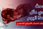 أمين محلي محافظة إب يتفقد أحوال الجرحى والمرضى بمستشفى الثورة